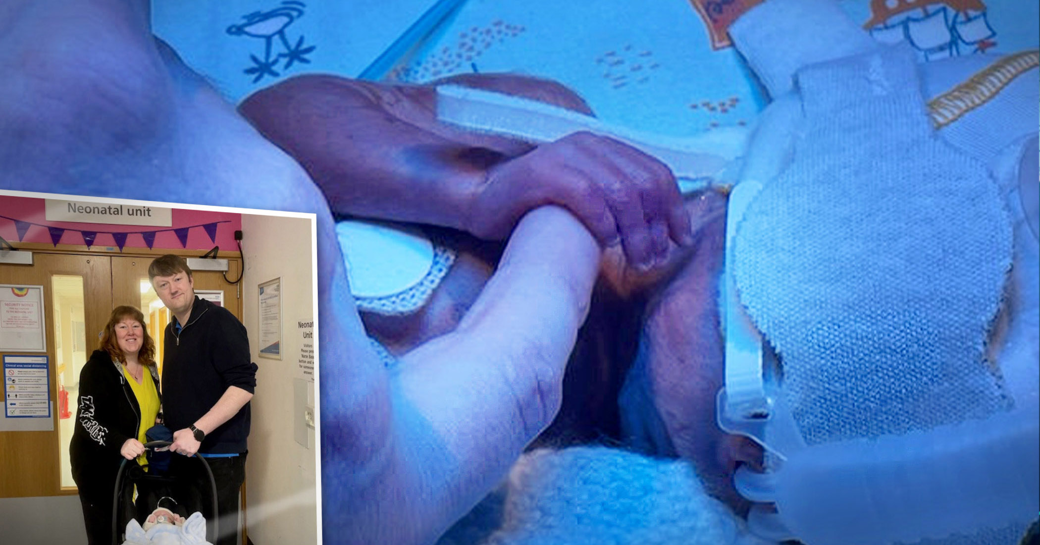 NextImg:Baby born 12 weeks early fits entirely in dad's hands, returns home after 4 months in NICU