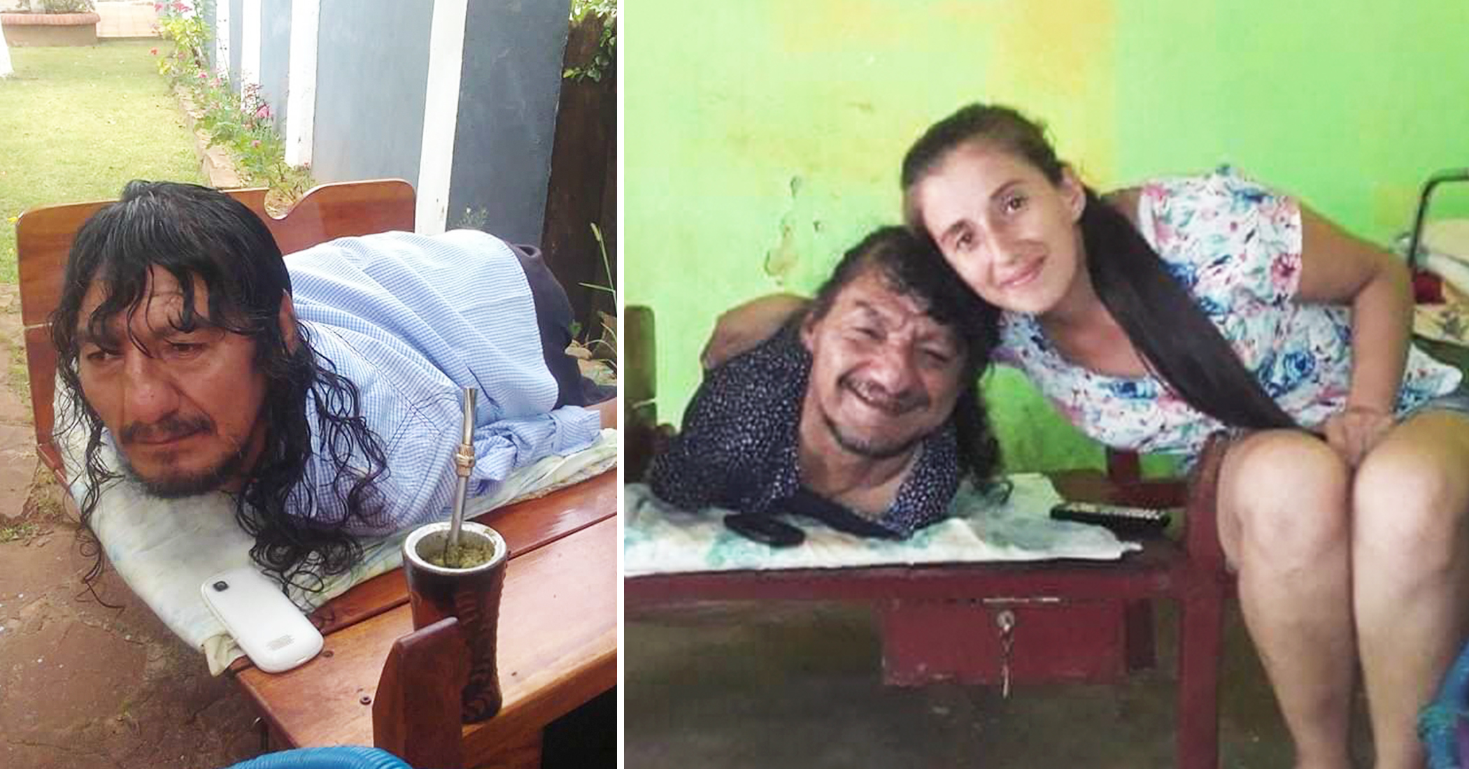 NextImg:‘Always seen with a smile’: Dad with no arms or legs raises two girls after their mom abandons them