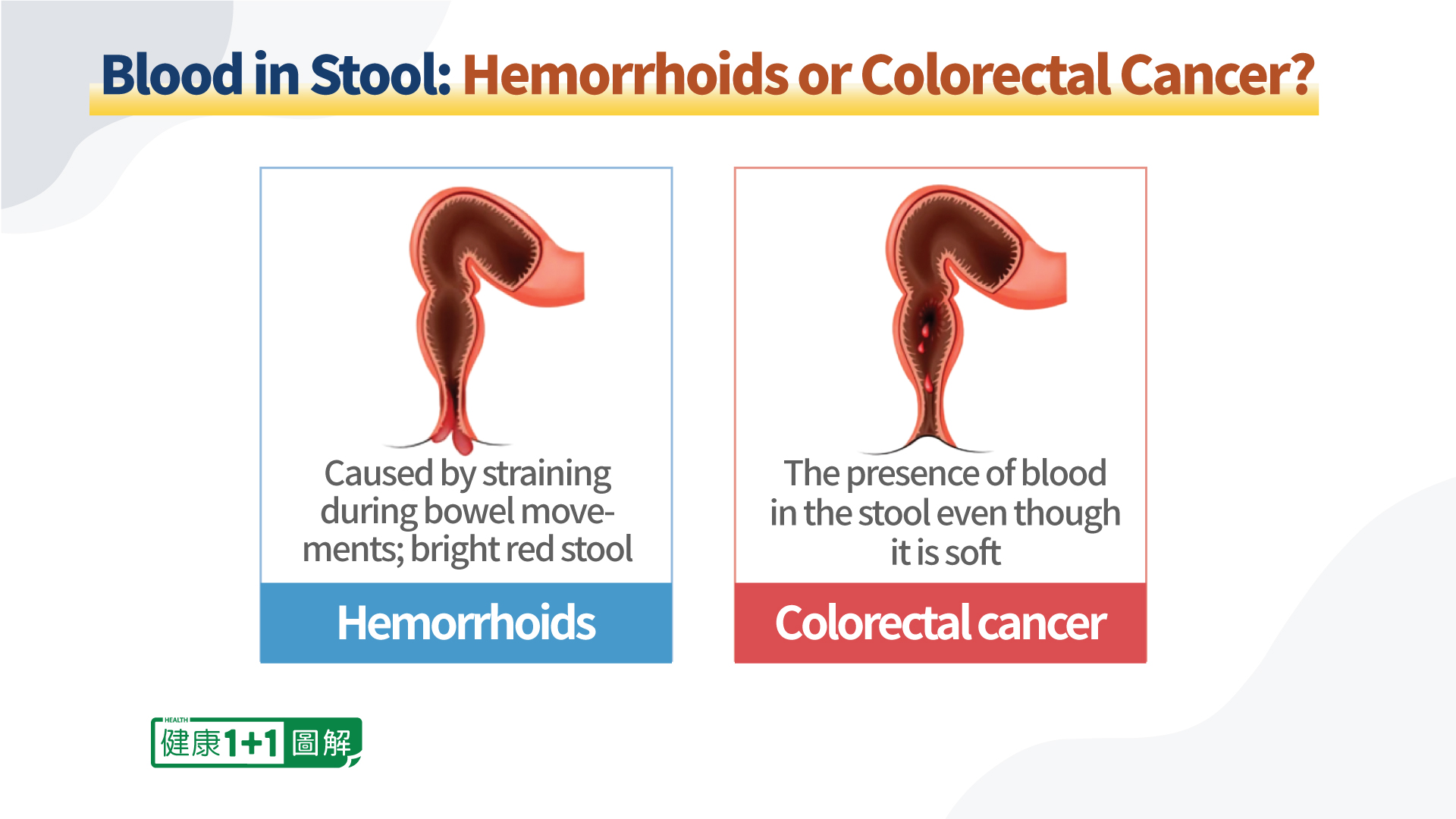 know-the-difference-between-hemorrhoids-and-colorectal-cancer-and-when