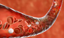3 Dietary Habits to Treat Anemia and Nourish the Blood