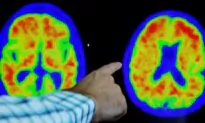 Japan’s Otsuka Pharma Gets FDA Approval for Alzheimer’s Agitation Drug