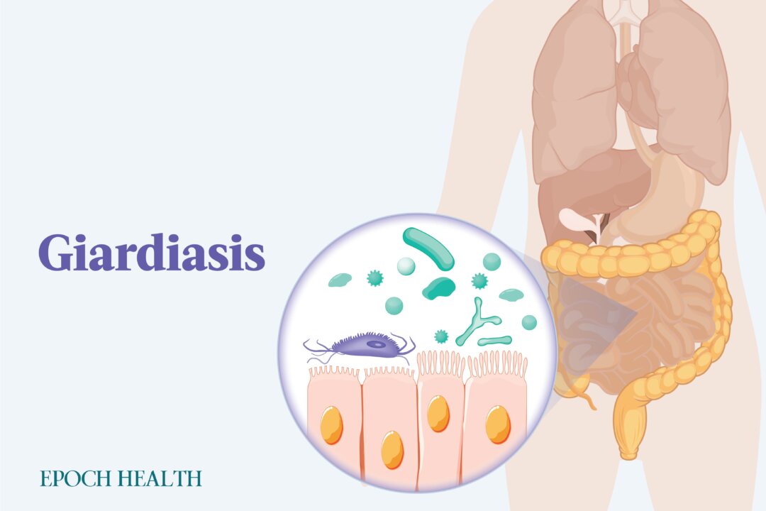 The waterborne Giardia parasite is the most common of its kind in the United States and causes a diarrheal infection called giardiasis. (The Epoch Times)