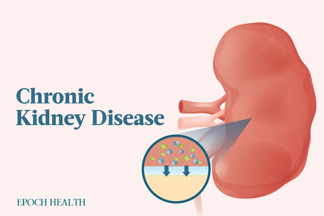 Chronic kidney disease has many causes, but fortunately, this means it is often a preventable disease. (The Epoch Times)