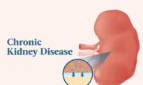 The Essential Guide to Chronic Kidney Disease: Symptoms, Causes, Treatments, and Natural Approaches