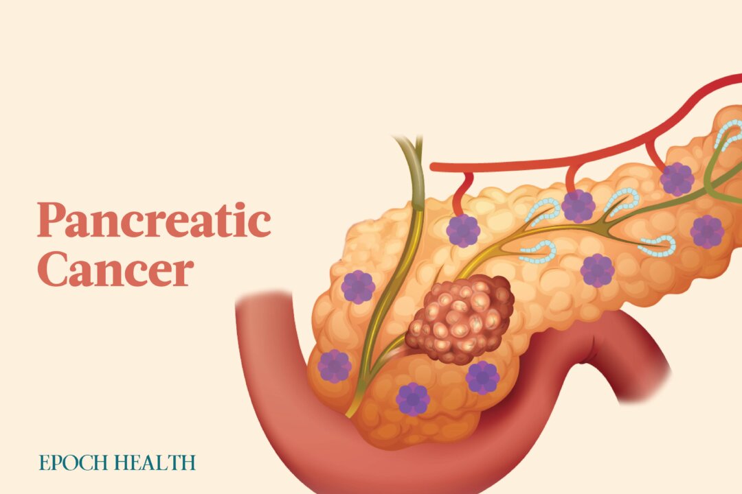 Pancreatic cancer is one of the most challenging forms of an already difficult disease. (The Epoch Times)