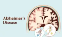 The Essential Guide to Alzheimer’s Disease: Symptoms, Causes, Treatments, and Natural Remedies