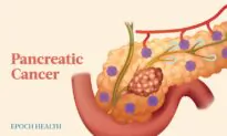 The Essential Guide to Pancreatic Cancer: Symptoms, Causes, Treatments, and Natural Approaches