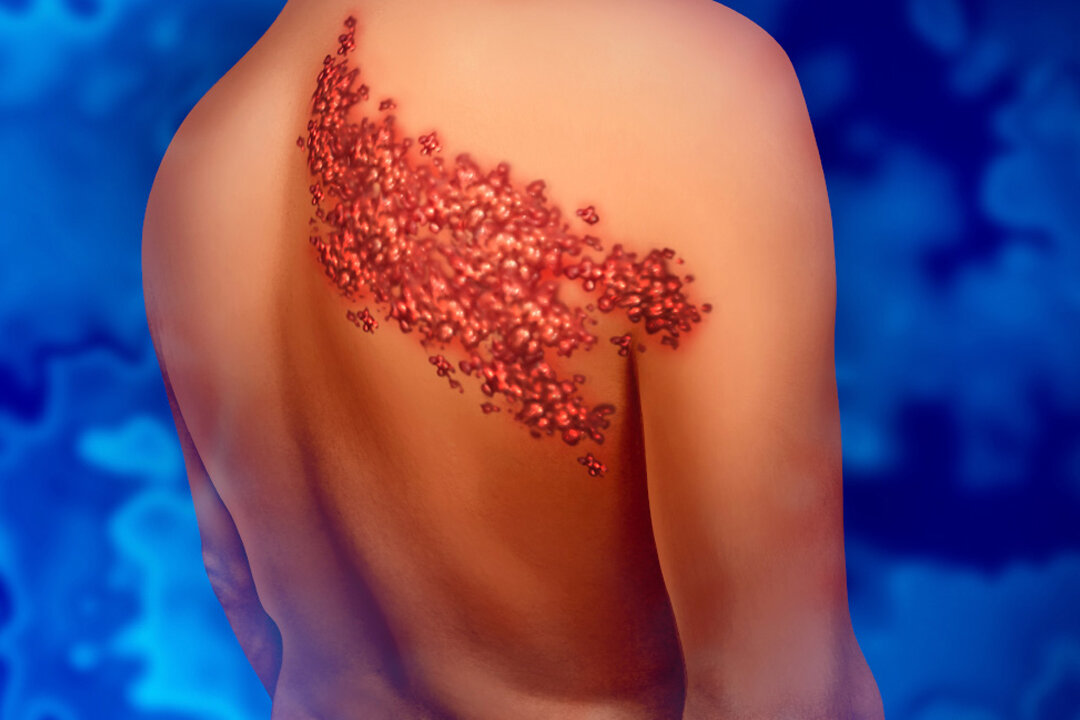 (Lightspring/Shutterstock)