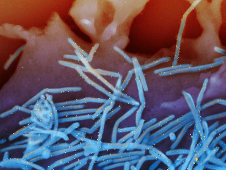 NextImg:FDA Panel Unanimously Endorses New RSV Antibody Drug for Infants