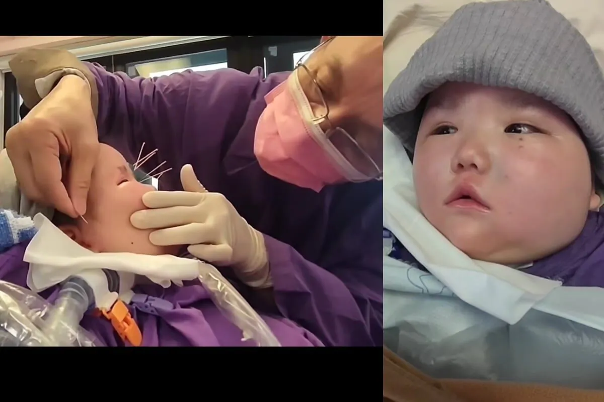 On May 19, 2023, Baby Tinyu blinked her eyes for the first time in three years. (Official Facebook Page of Tinyu's Concern Group)