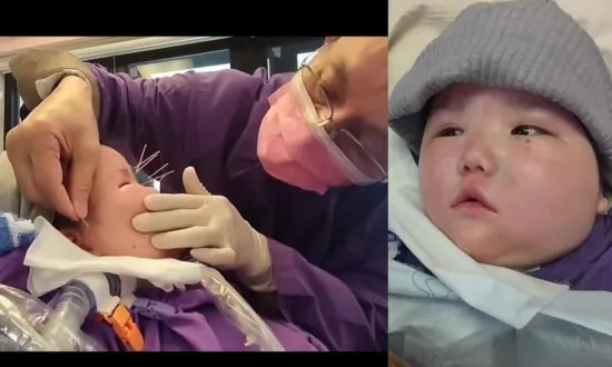 7-Years-Old Girl in Vegetative State Blinks for the First Time in 3 Years After Acupuncture Treatment