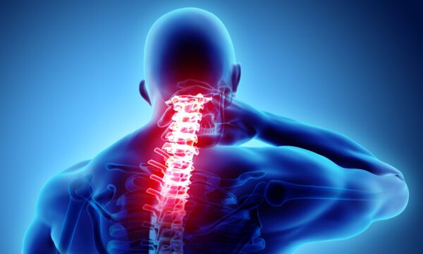 Brain Scans Within Days of Neck Injury May Predict Chronic Pain