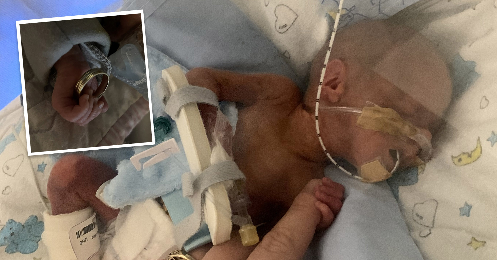 NextImg:Premature baby whose hand was smaller than the size of his mom's wedding ring is thriving