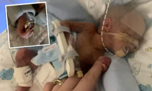 Premature Baby Whose Hand Was Smaller Than the Size of His Mom’s Wedding Ring Is Thriving