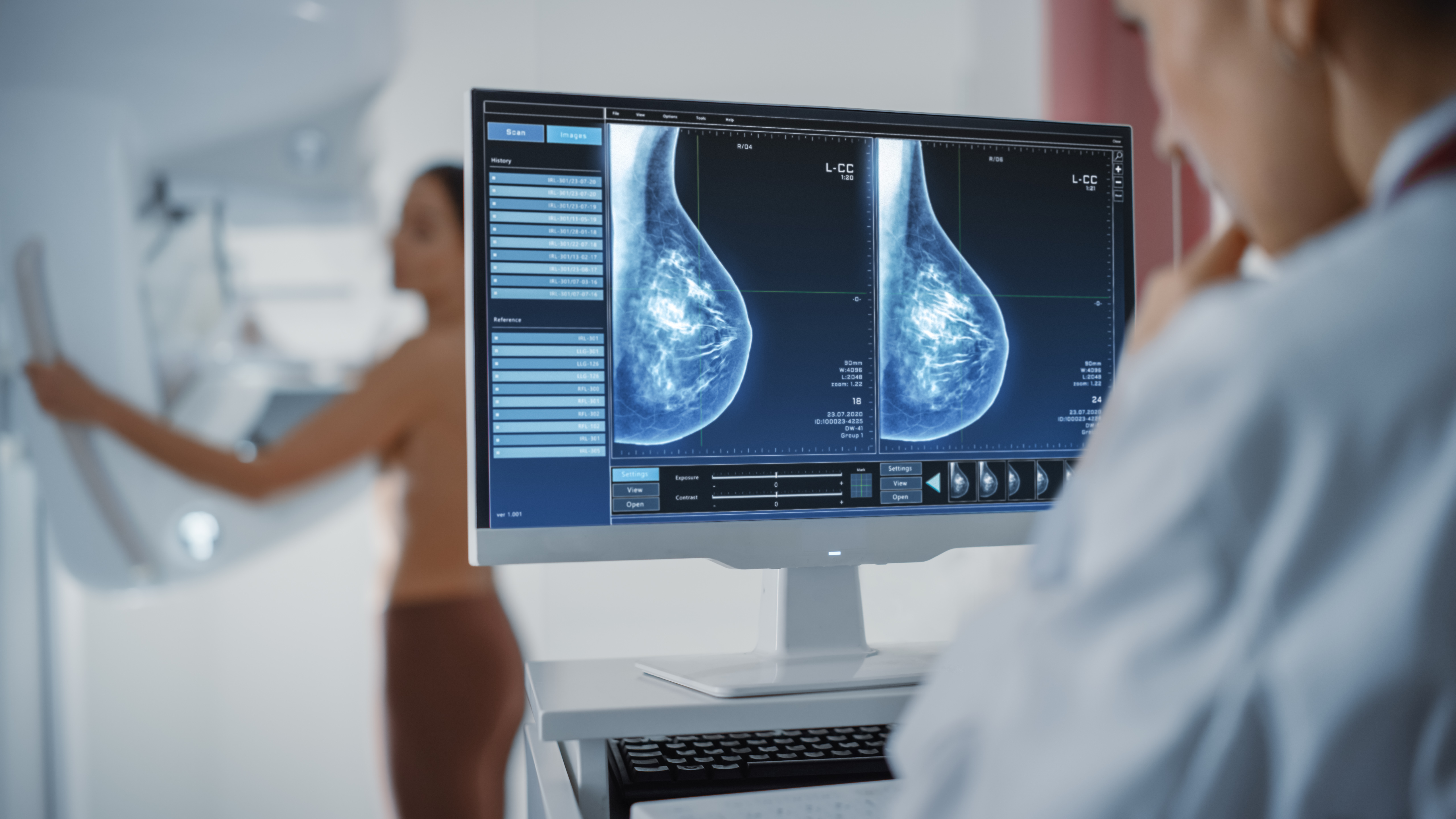 Why the New Breast Cancer Screening Guidelines Won't Save More Women