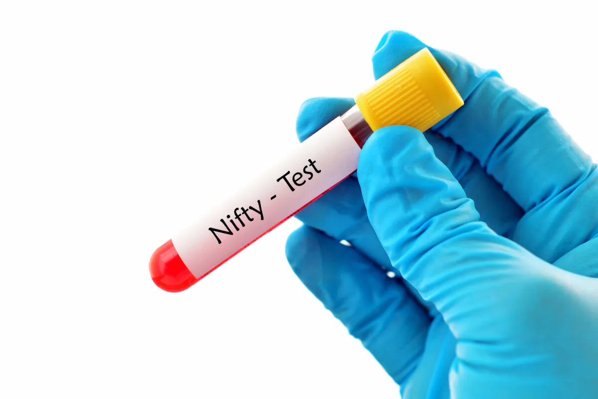 Blood sample for NIFTY or Non Invasive Fetal Trisomy test, diagnosis for fetal Down syndrome in pregnancy woman. (Jarun Ontakrai/Shutterstock)