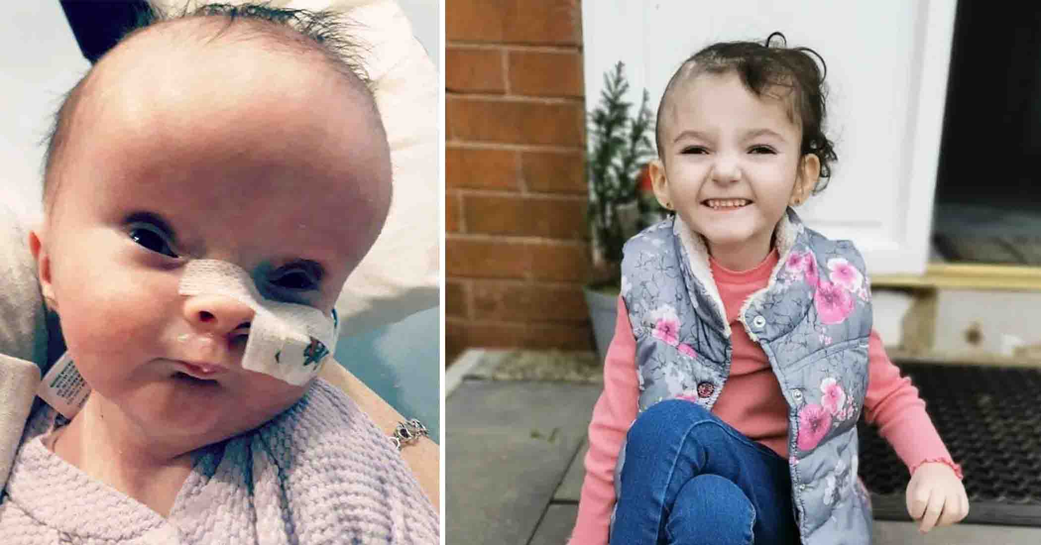 NextImg:Baby born with a brain condition that made her look like an alien is now 5 and thriving
