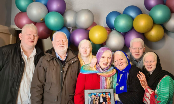 'I Like Who I Am': Albino Asian Family With World Record for Most Albino Siblings Tells Their Story