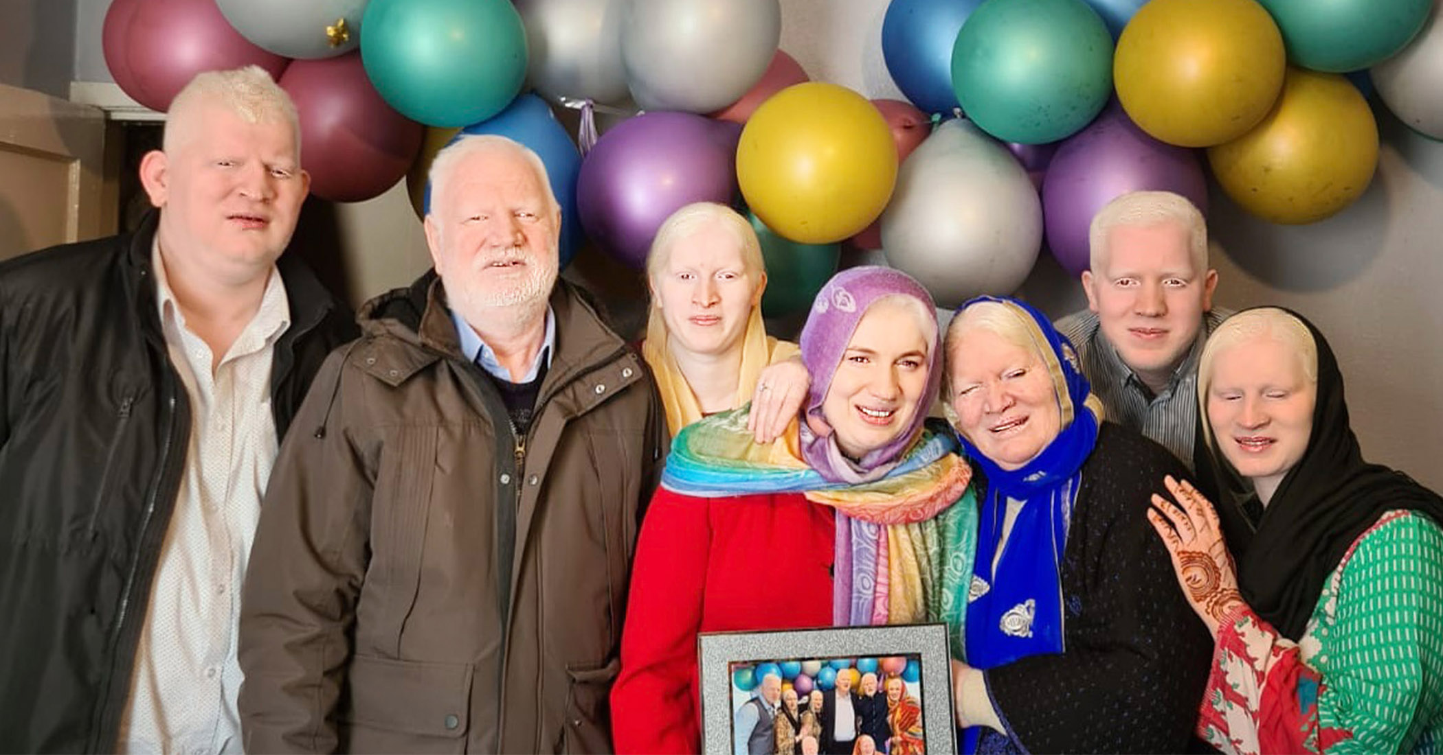 NextImg:'I like who I am': Albino Asian family with world record for most albino siblings tells their story