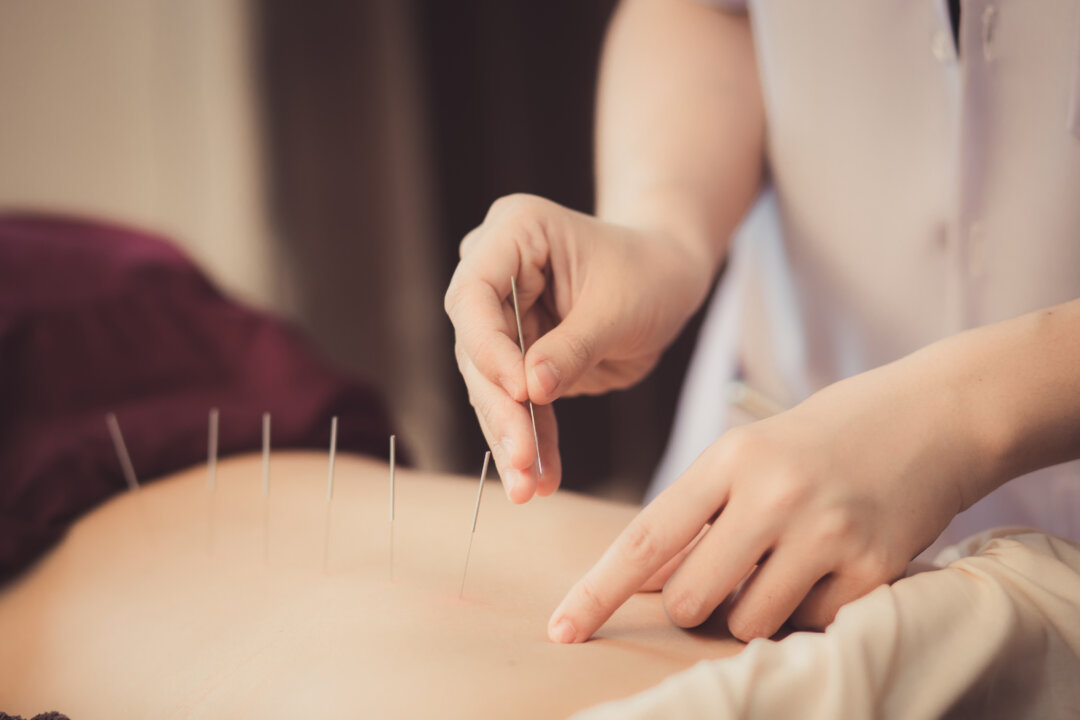 Acupuncture proved effective for patients receiving dialysis treatment. (NiP STUDIO/Shutterstock)