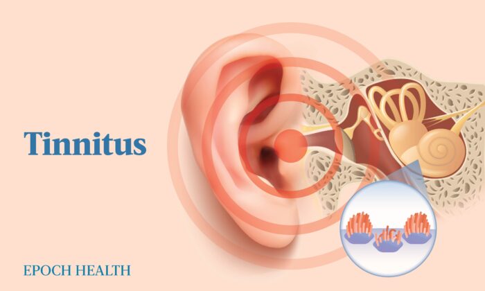 The Essential Guide to Tinnitus: Symptoms, Causes, Treatments, and Natural Approaches