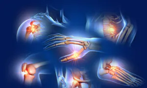 Chronic Pain Shows Alarming Trend, Surpasses Other Common Chronic Diseases