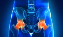Chronic Hip Pain: Common Causes, 5 Exercises to Relieve
