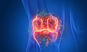 Chronic Knee Pain: 2nd Leading Cause of Pain, 5 Easy Home Exercises to Relieve