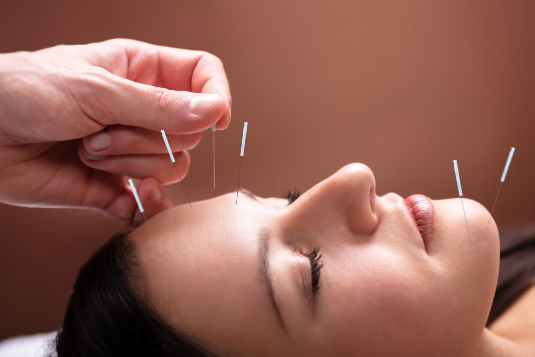 Chrono-Acupuncture for Facial Rejuvenation and Cosmetic Enhancement