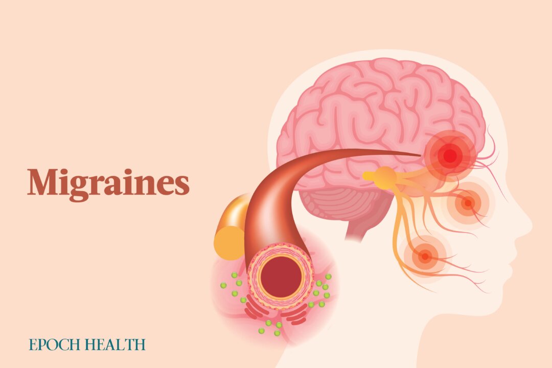 While migraines don't have a conclusive cause, they do have many triggers. (The Epoch Times)
