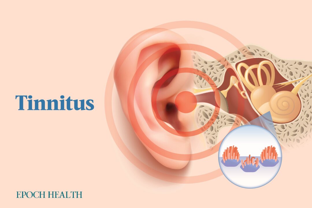 Tinnitus affects about 20 percent of Americans. (The Epoch Times)