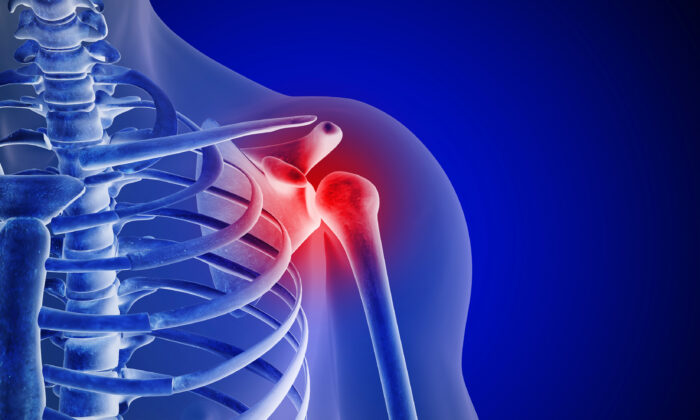 A Surprising Reason for Shoulder Pain 