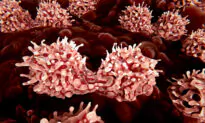 Stem Cell Gene Therapy Trial for Children Launches in Australia