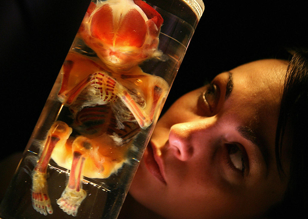Researchers Create Synthetic Human Embryos Without Sperm or Eggs
