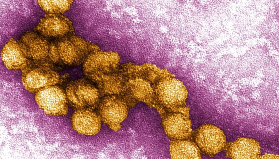 A micrograph of the West Nile Virus in a 2014 photo. (Cynthia Goldsmith, P.E. Rollin, US Centers for Disease Control and Prevention)