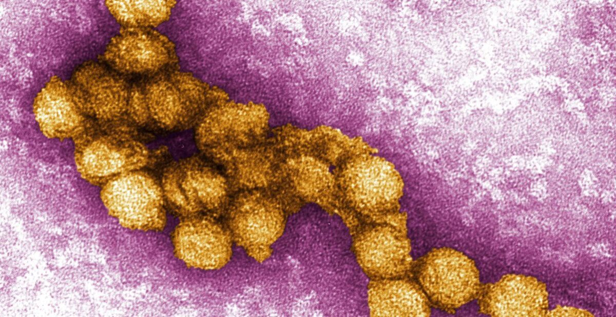 NextImg:Officials Issue Alerts About Potentially Deadly Mosquito-Borne Virus Across US