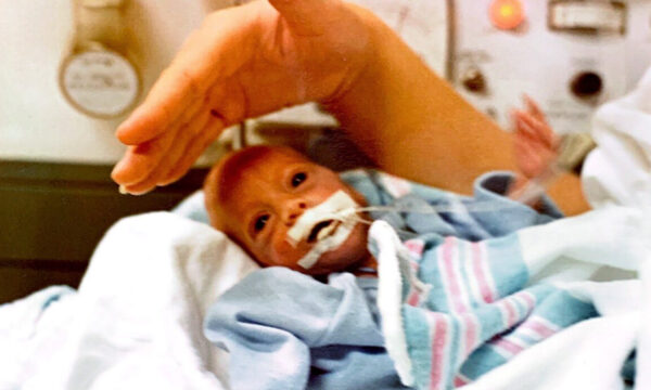 Lauren Eden was born in 1982 at 26 weeks.