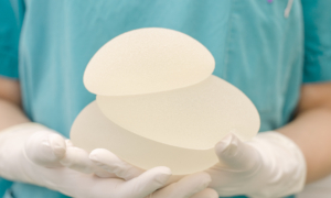 The Very Real Consequences of Breast Implant Illness