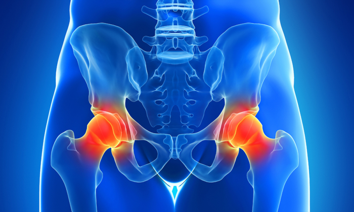 A Therapist's 5 Best Exercises for Chronic Hip Pain