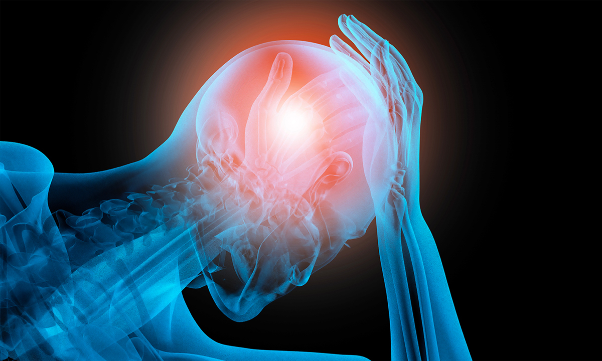 Vestibular Therapy as a Drug-Free Headache Treatment Option