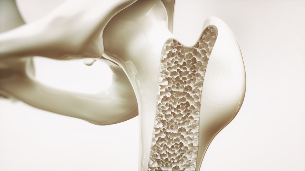 NextImg:A Functional Approach to Osteoporosis and Bone Health