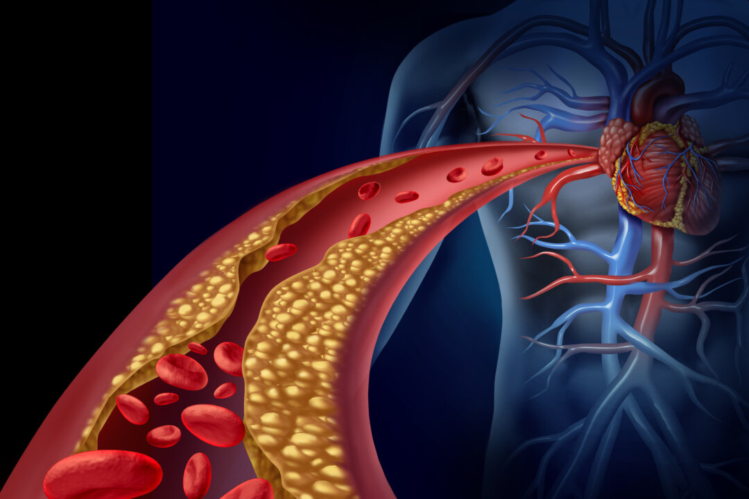 Berberine May Reduce Atherosclerosis, Promising Study Finds