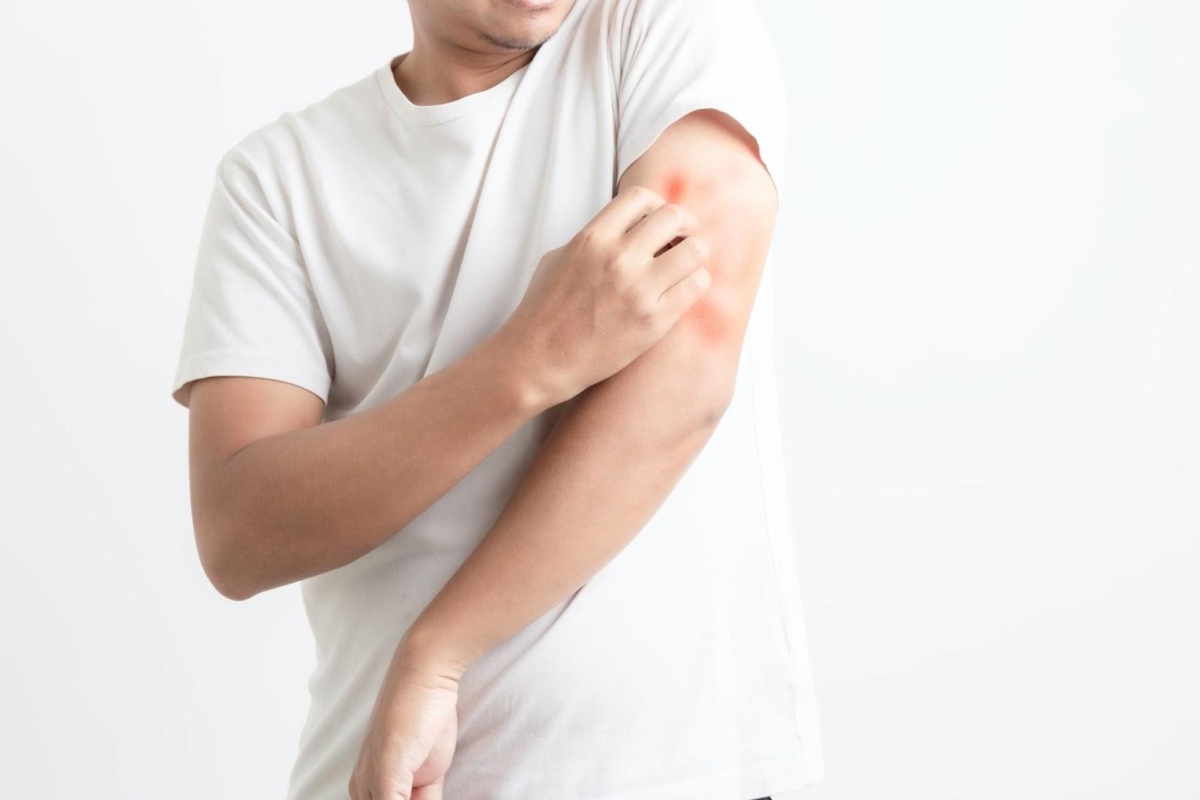 Ancient Wisdom's Remarkable Impact: Eczema Vanishes, Weight Drops by 30 Pounds in Just 1 Month
