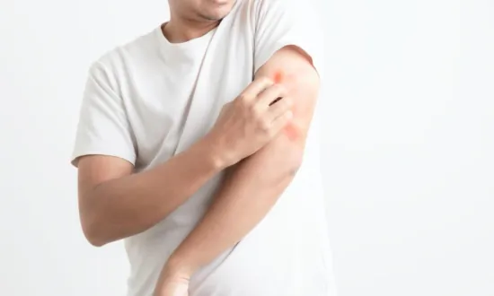 Ancient Wisdom’s Remarkable Impact: Eczema Vanishes, Weight Drops by 30 Pounds in Just 1 Month