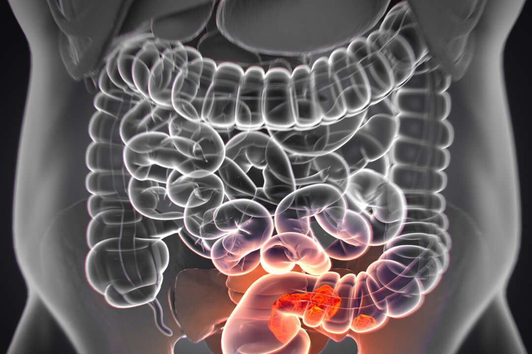 (Anatomy Image/Shutterstock)
