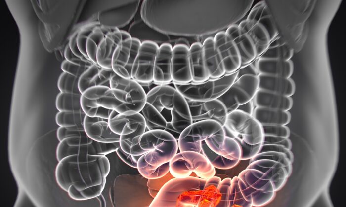 8 Major Risk Factors for Colorectal Cancer and 3 Tips for Nurturing Digestive Health