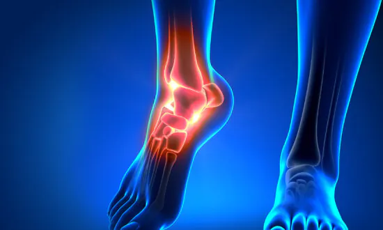 Chronic Ankle Pain: Often Caused by Weak Ankles, 5 Exercises to Strengthen and Prevent Injury