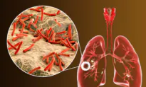 Major Setback in Shortened Tuberculosis Treatment as Clinical Trial Fails