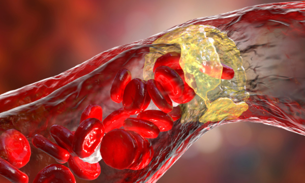 'Bad' Cholesterol May Not Be So Bad