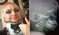 Woman Who Fell 12 Feet Fracturing Her Neck During a Cigarette Break Says, ‘It’s a Miracle I’m Alive’